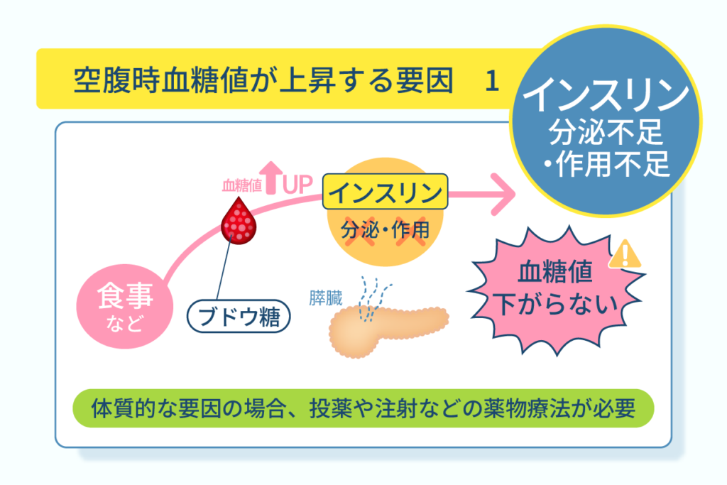 空腹時血糖値が上昇する要因１インスリン分泌不足・作用不足